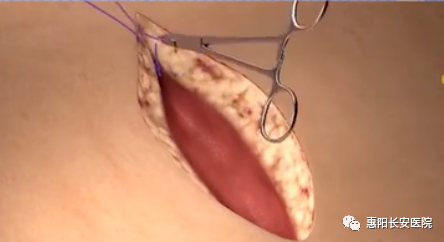 1693208277643774.png image.png