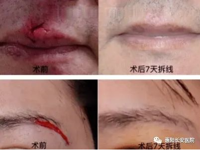 1693208292213064.png image.png