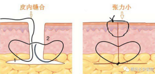 1693208304175640.png image.png