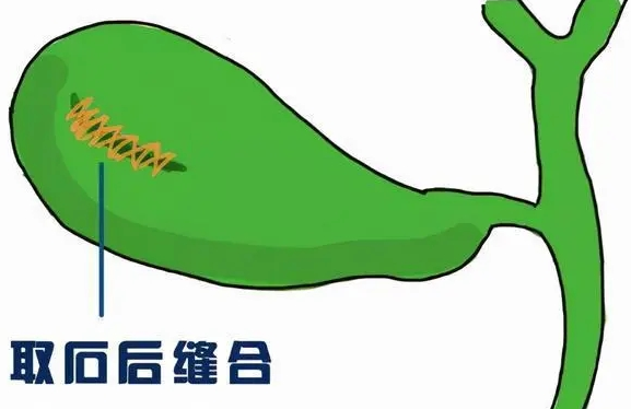 1781668415675817.png